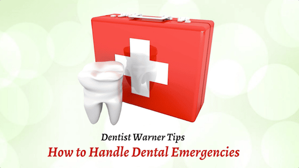 How to Handle Dental Emergencies