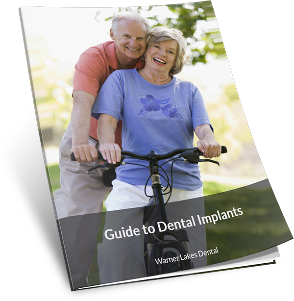 Guide to Dental Implants by WLD