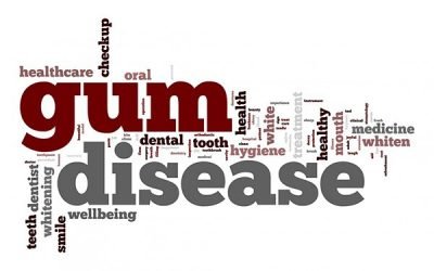 Gum Disease, Can It Be “Cured”?