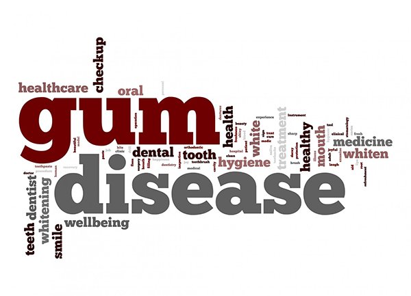 Gum Disease, Can It Be “Cured”?