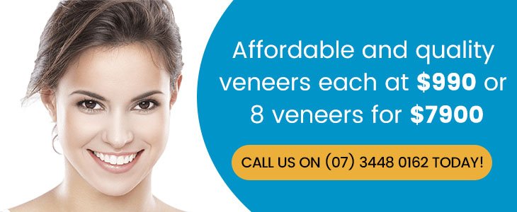 Dental Veneers Promotions Banner Dentist Warner