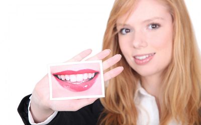 All About Porcelain Veneers