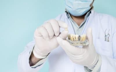 Warner Lakes Dental Tips: Are Dental Implants Really the Best Solution for Missing Teeth?
