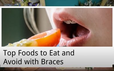 Top Foods to Eat and Avoid with Braces from Warner Lakes Dental