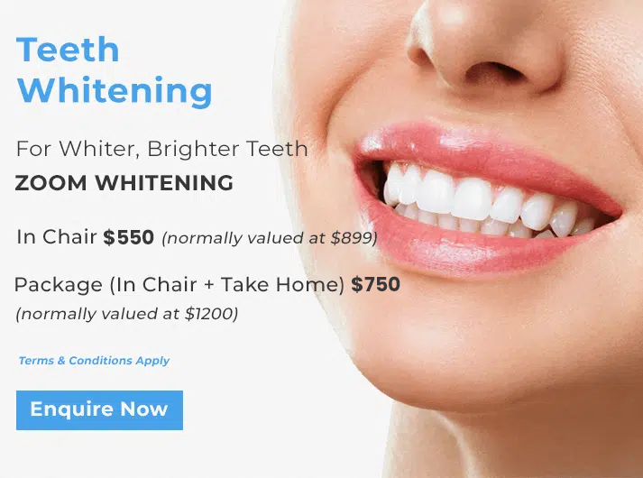 teeth whitening promo banner warner