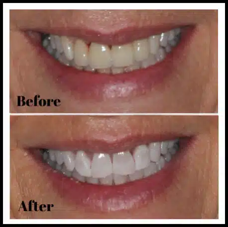 before_after_smiles