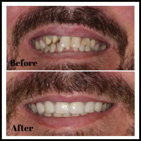 before_after_smiles1